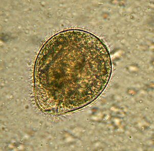 Balantidium is the largest protozoan parasite