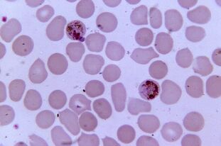 Plasmodium of malaria