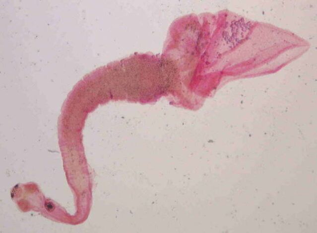 human body pork tapeworm