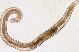 parasites of man threadworm